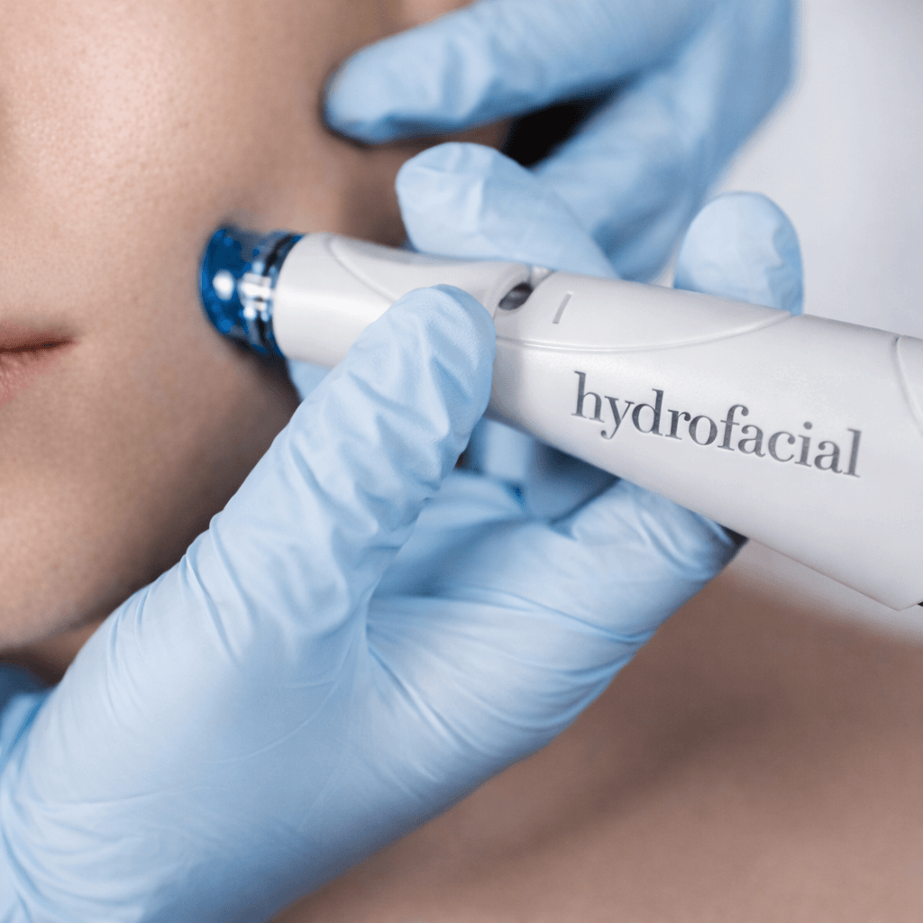 Hydrofacial vortex technology in action