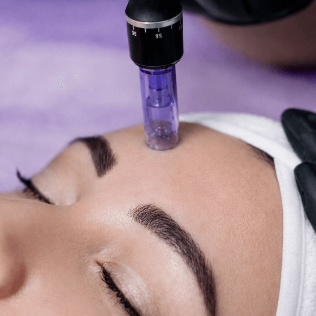 Nano-needling treatment process