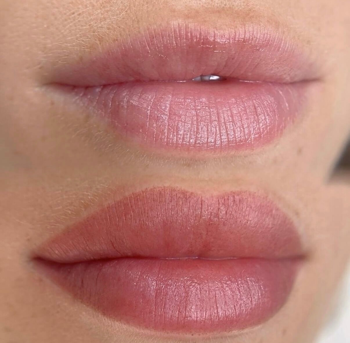 Client receiving permanent makeup treatment